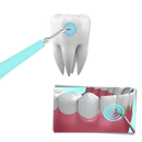 Deep Cleaning Tooth Tartar Machine